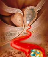 前列腺檢查檢測早期前列腺病變