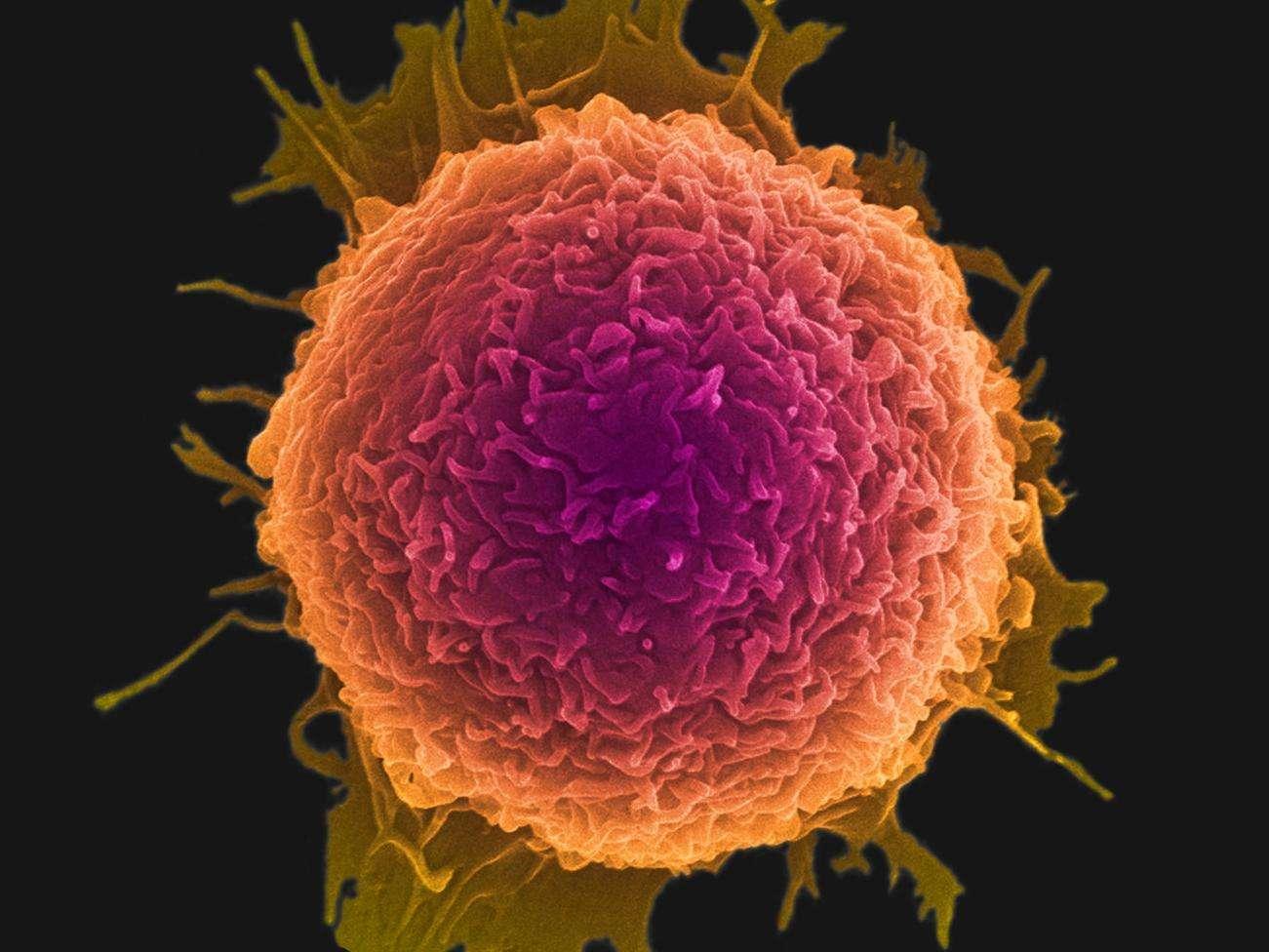 科學家鎖定腫瘤幹細胞，治癒癌症真的有可能嗎？