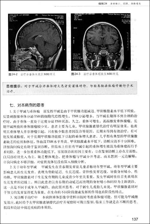 內分泌疾病臨床診療思維