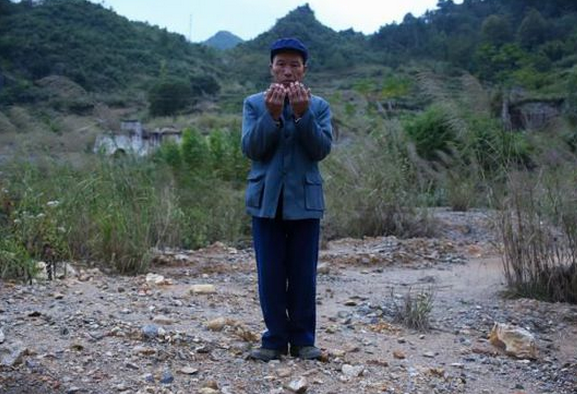 三合村村民黃純普展示他變形的手