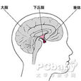 空蝶鞍症 空蝶鞍症