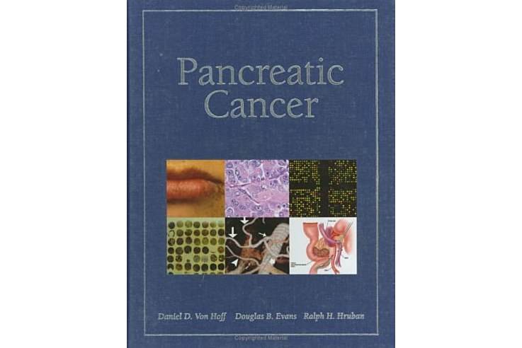 Pancreatic Cancer Pancreatic Cancer