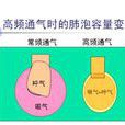高頻通氣 高頻通氣