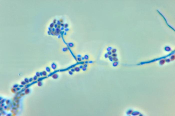 申克氏孢子絲菌