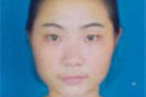 張笑毓 張笑毓