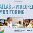 The Atlas of Video-EEG Monitoring The Atlas of Video-EEG Monitoring