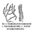 布勒現象