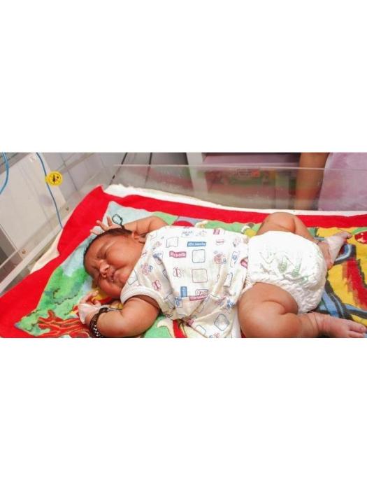印度最重嬰兒 印度最重嬰兒