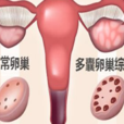 多囊 多囊
