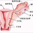 子宮性不孕 子宮性不孕