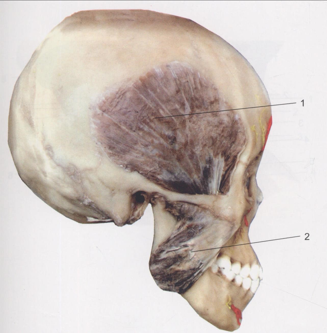 1.顳肌 temporalis 側頭筋  2.咬肌 masseter 咬筋