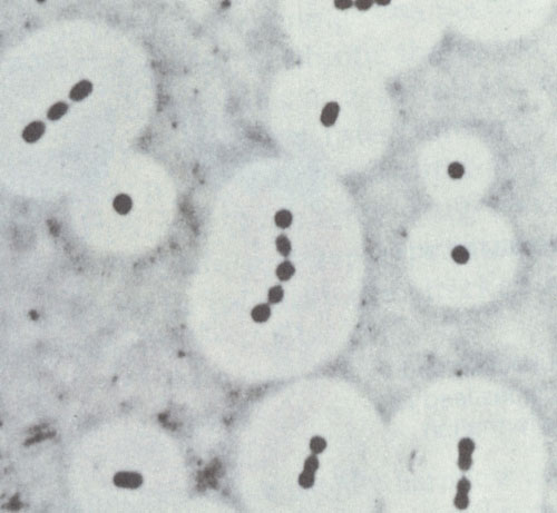 肺炎鏈球菌(乳桿菌目細菌)