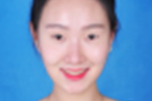張雅迪 張雅迪
