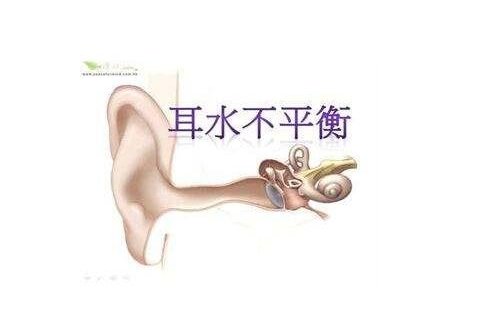 耳水不平衡 耳水不平衡