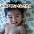 嬰兒抽動症 嬰兒抽動症