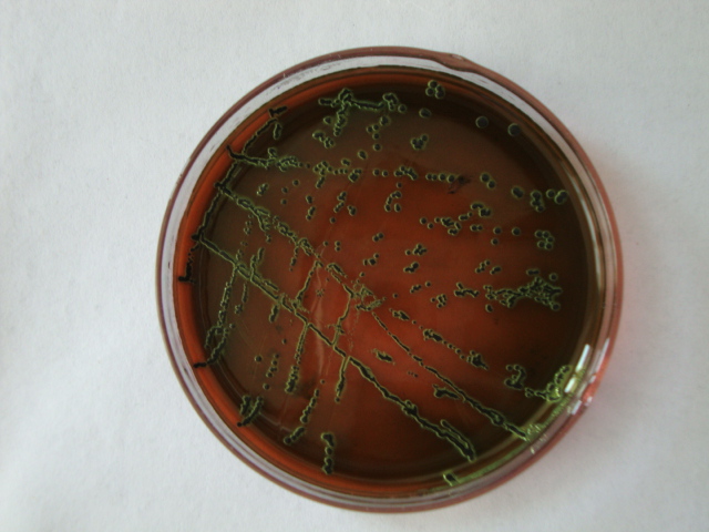 生長大腸桿菌的EMB培養基