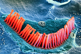 在放大的照片中可看到耳蝸內的毛細胞