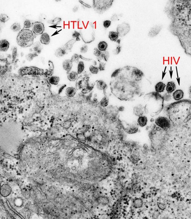 HTLV-I病毒