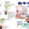 腦血管意外 腦血管意外