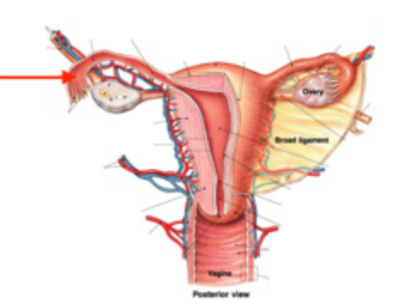 骶子宮韌帶