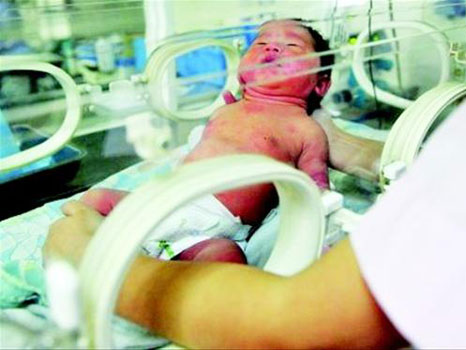 被遺棄的女嬰在四川省人民醫院接受治療