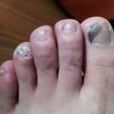 灰脂甲 灰脂甲
