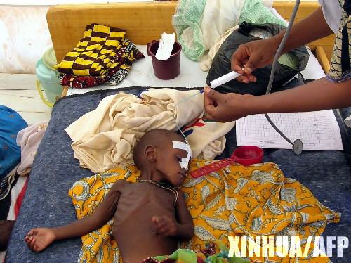 無國界醫生為一名尼日兒童進行救助