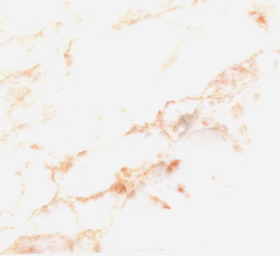 水晶紅玉 水晶紅玉