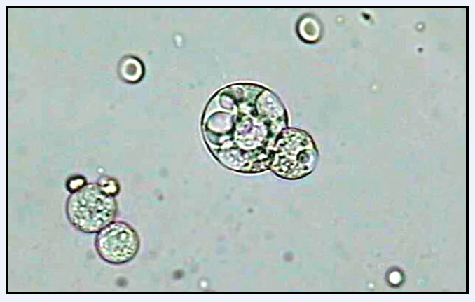 圖6 吞噬細胞形態