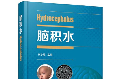 腦積水(2020年化學工業出版社出版的圖書) 腦積水(2020年化學工業出版社出版的圖書)