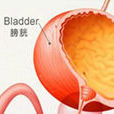 小兒膀胱腫瘤 小兒膀胱腫瘤