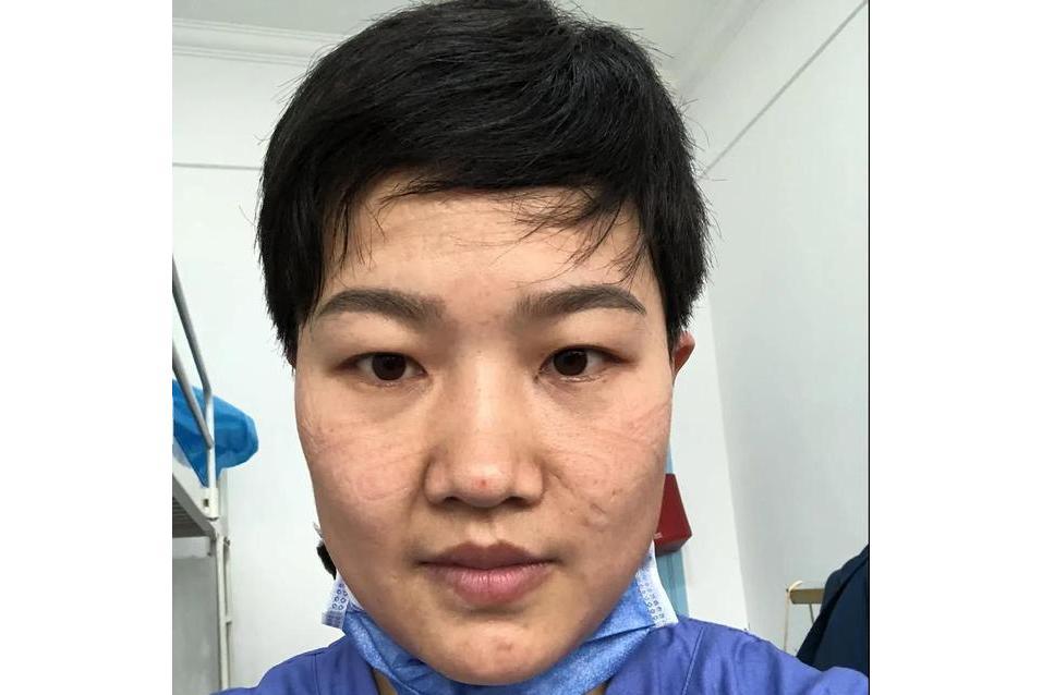 舒琴(安順市關嶺自治縣人民醫院護理人員) 舒琴(安順市關嶺自治縣人民醫院護理人員)