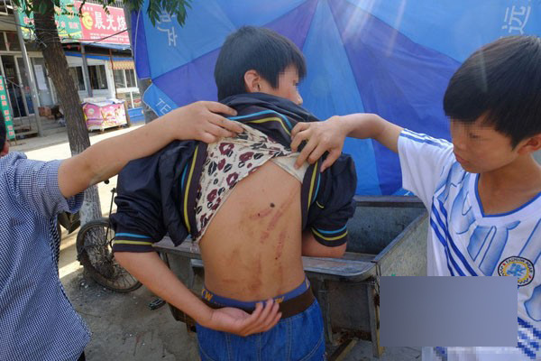 北京3男子圍毆少年事件