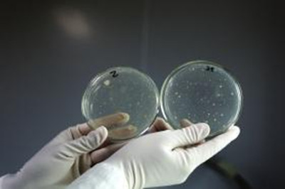 細菌污染指標