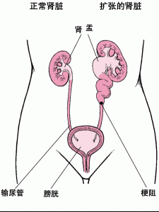 腎臟在人體中的位置