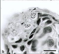 可見到兩個孢子囊中有多個游離孢子。