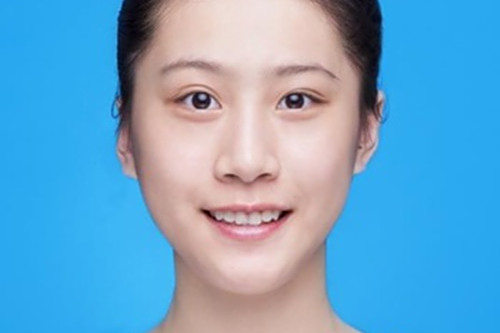 方馨蕊 方馨蕊