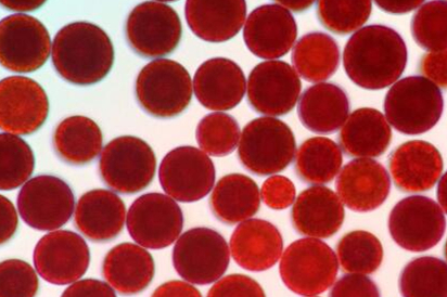 遭受壓力後的雨生紅球藻細胞