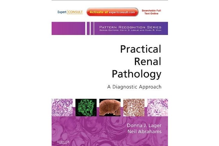 Practical Renal Pathology, a Diagnostic Approach(Lager, Donna J.,Abrahams, Neil 所著圖書) Practical Renal Pathology, a Diagnostic Approach(Lager, Donna J.,Abrahams, Neil 所著圖書)