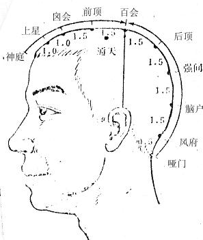 後頂穴