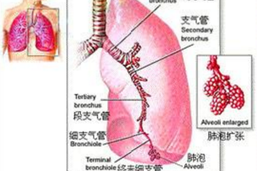 誘導痰法 誘導痰法