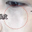 卡粉 卡粉