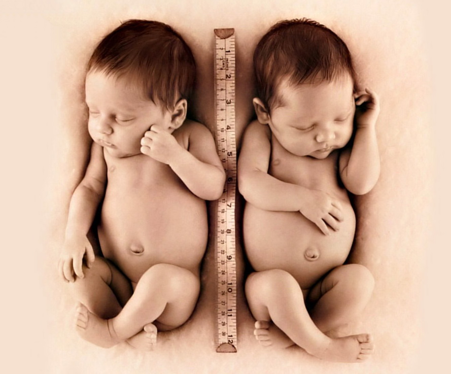 雙胞胎(胎生動物一次懷胎生下兩個個體)