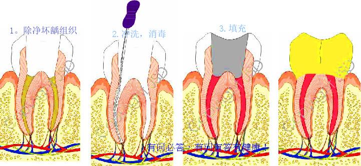 糖(化合物)