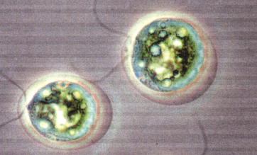 成長階段的綠色雨生紅球藻細胞