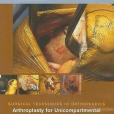 Arthroplasty for Unicompartmental Knee Arthritis Arthroplasty for Unicompartmental Knee Arthritis