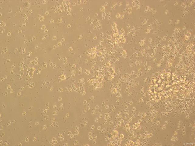 樹突狀細胞