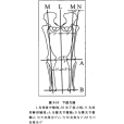 下肢力線 下肢力線