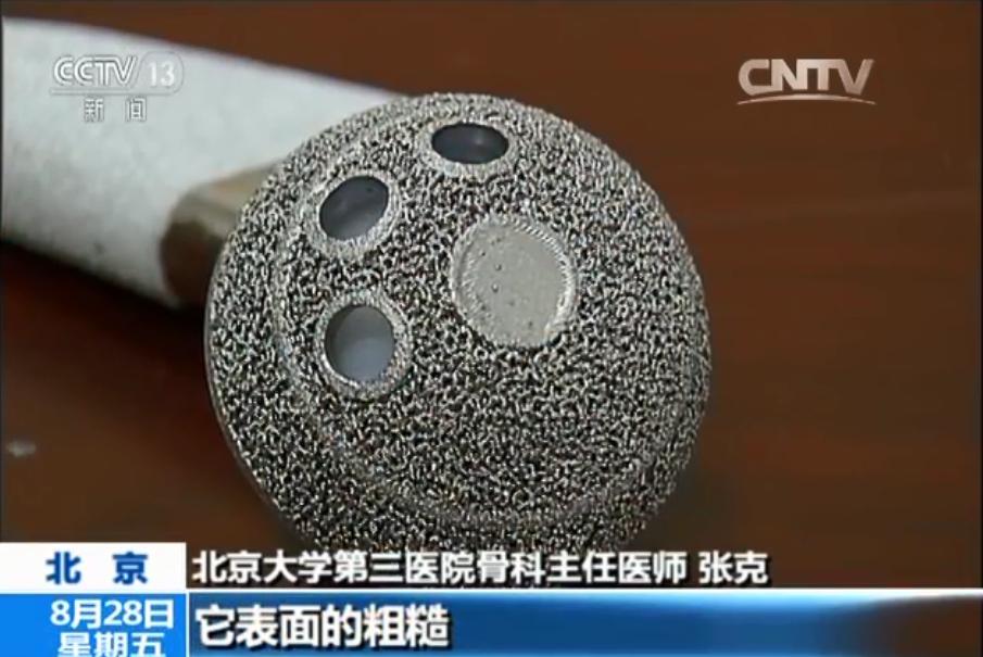 央視報導國內首例3D列印人工髖關節產品