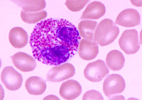 圖片為嗜酸性粒細胞，為血液內組分。
